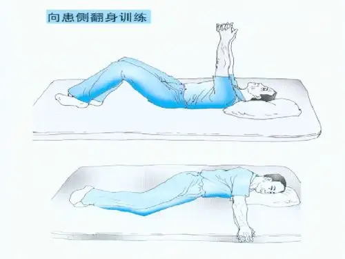 偏瘫患者的康复训练方法