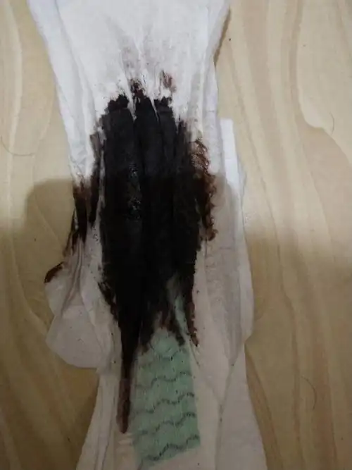 月经一直这种颜色是什么原因