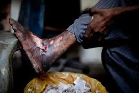 印度瘾君子将吸毒进行到底不吃饭可以不吸毒则要命