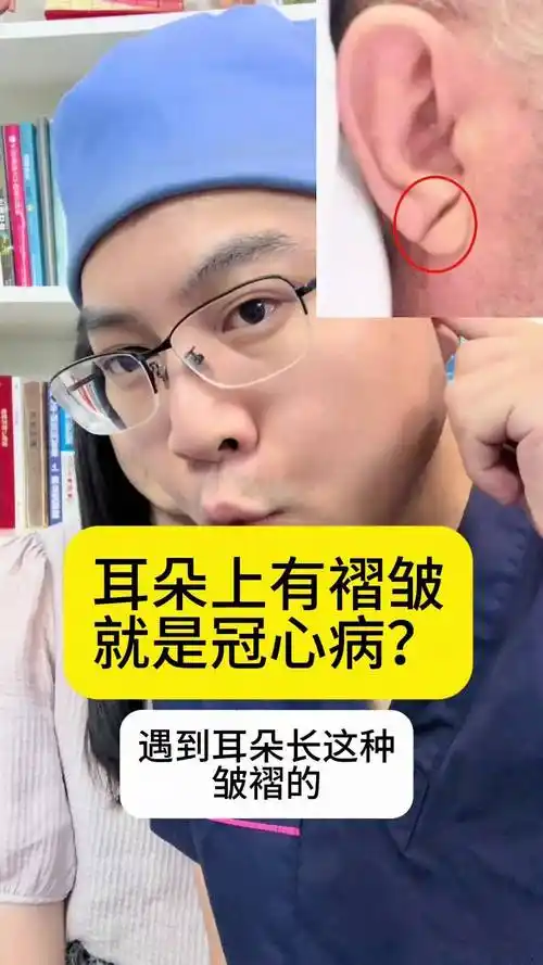 耳朵有皱褶就有冠心病抖出健康知识宝藏医学科普健康心脏病