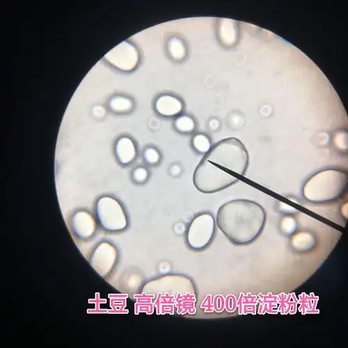 廖晓琪/曹思怡 写美篇这张是第一次显微镜下土豆淀粉粒实验中拍的