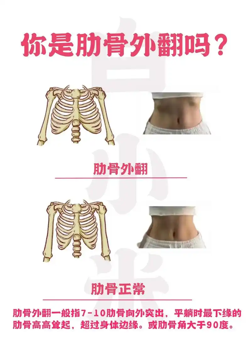 97超级干货|肋骨外翻自测及解决思路.够全面吗?