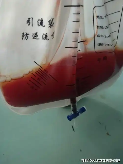 同样都是胸腔积液,为什么它们的颜色不一样?