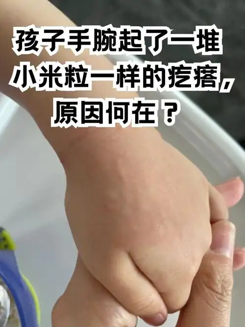 孩子手腕起了一堆小米粒一样的疙瘩,原因何在?