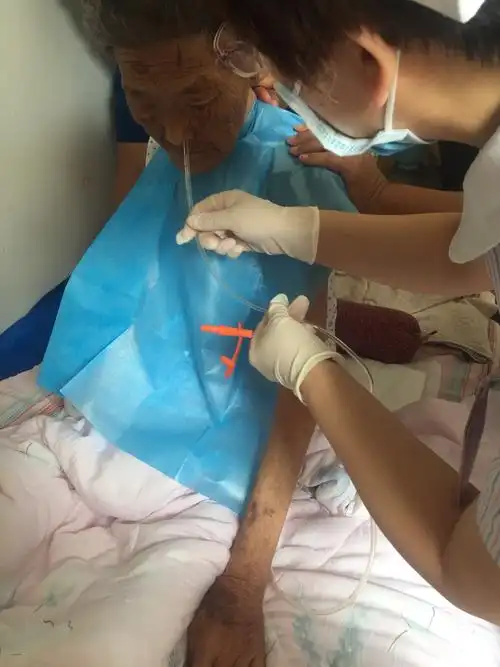 延续性护理——留置胃管