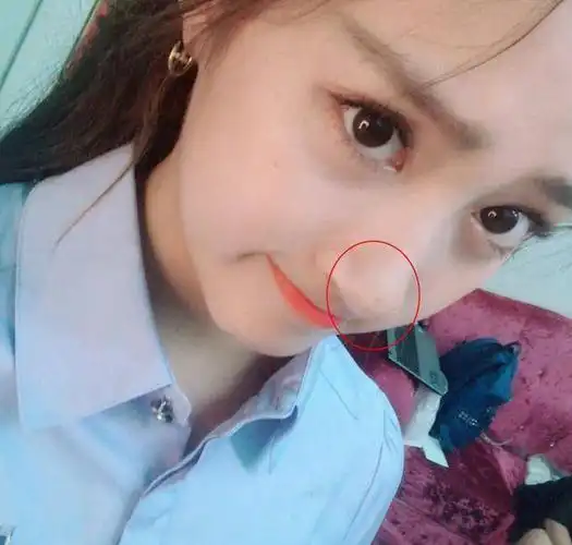 女星"水滴鼻"大比拼,关晓彤baby垫底,第一你绝对想不到!