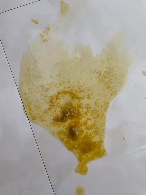 讨论猫猫呕吐内有呕吐物图片慎点