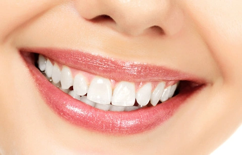 激光美白牙齿需要多长时间