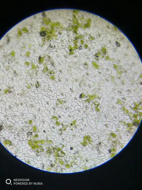 菠菜叶下表皮,质地太软,容易粘上叶肉.