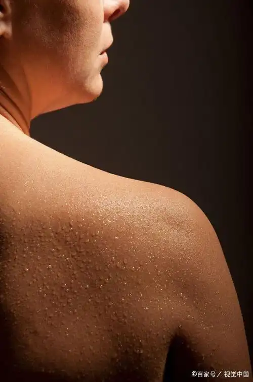 中医为什么不提倡"大汗淋漓"?4个部位出汗可能提示疾病