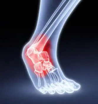 腿漆盖关节疼痛是怎么回事