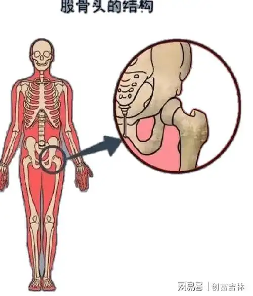 股骨头坏死是一个病理演变过程,初始发生在股骨头的