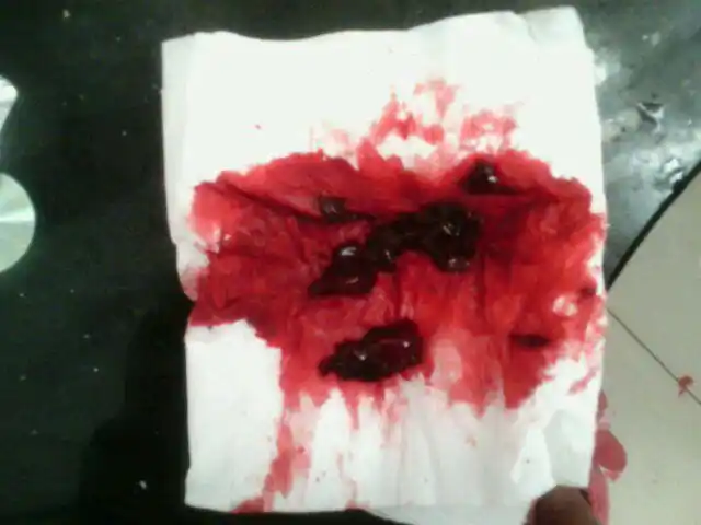 同房后会有一点出血 来完月经十多天了