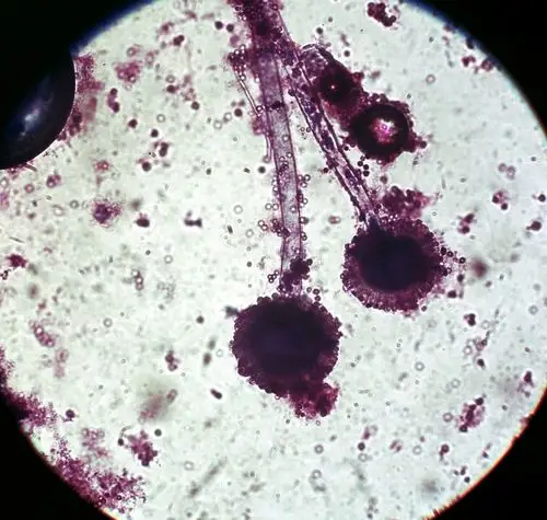 显微镜下的霉菌