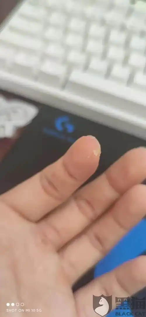 带上oppo w51后耳朵里结疤流水还可痒