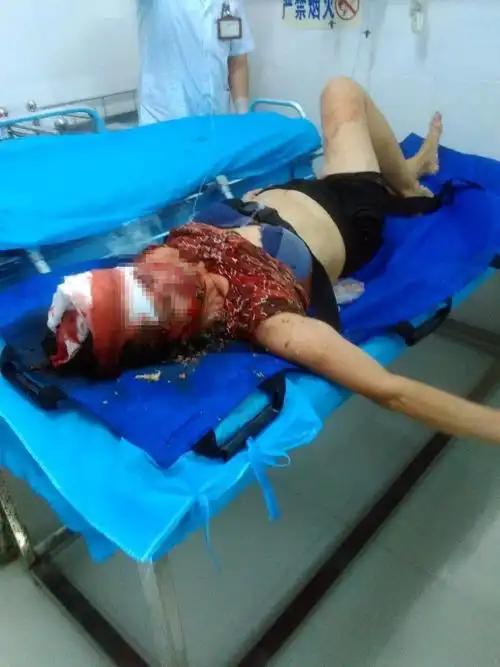 太残忍!广西街头一精神病患锤死过路女子!可怕!