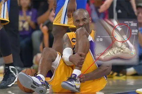 直接导致跟腱断裂,以科比的话说"他听到了骨头断裂