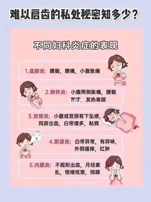 妇科知识小科普