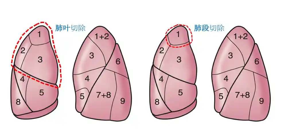 肺还能造血?我们帮你保住宝贵的肺!