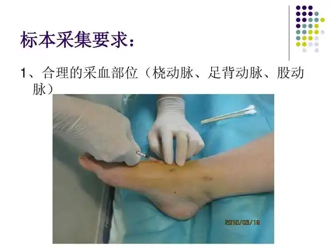 标本采集要求: 1,合理的采血部位(桡动脉,足背动脉,股动 脉)