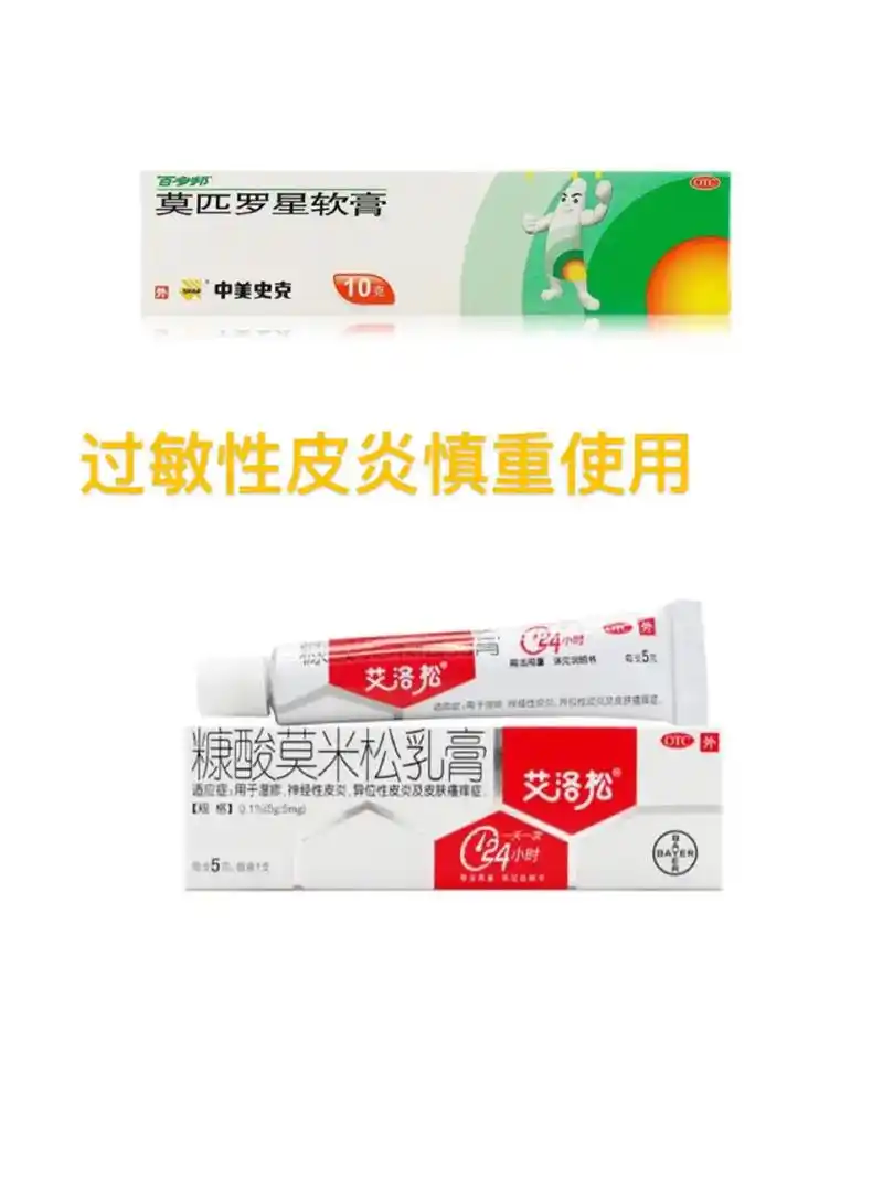 皮肤过敏77皮炎 抗敏之路分享.