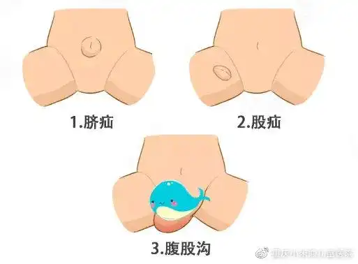 2岁男娃睾丸坏死失去生育能力重庆小米熊儿童医院只因这个原因