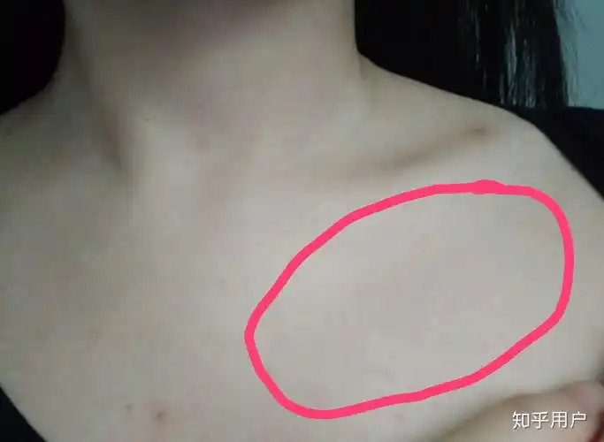 锁骨之间正下方有一块凸起的骨头,虽然平滑的看不太出来,但是用手还是