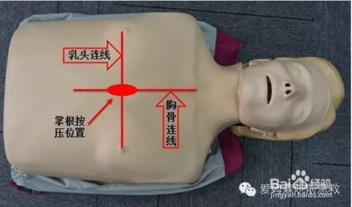 胸外按压——偶巴是这样做的:(偶巴你按错位置了~~~t.