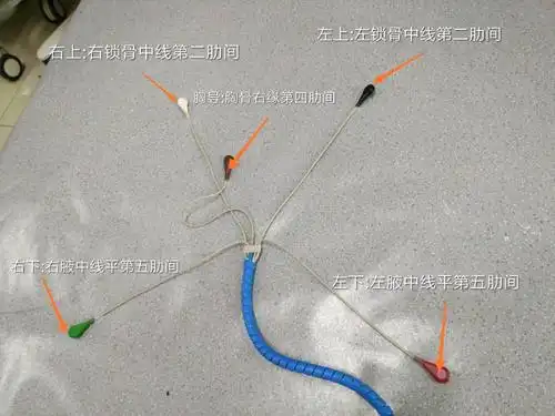 床旁心电监护仪