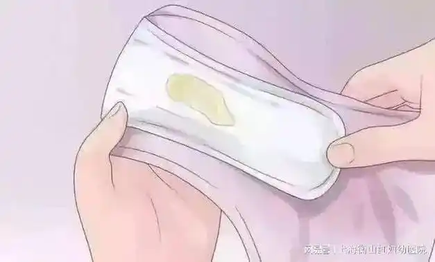 一般情况下,这种情况出现的原因与女性在使用卫生护垫时不注意卫生