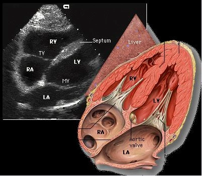 二维超声心动图常用切面及选择