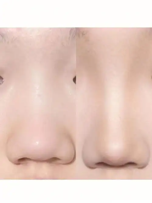 蒜头鼻修容详细版来啦进来抄