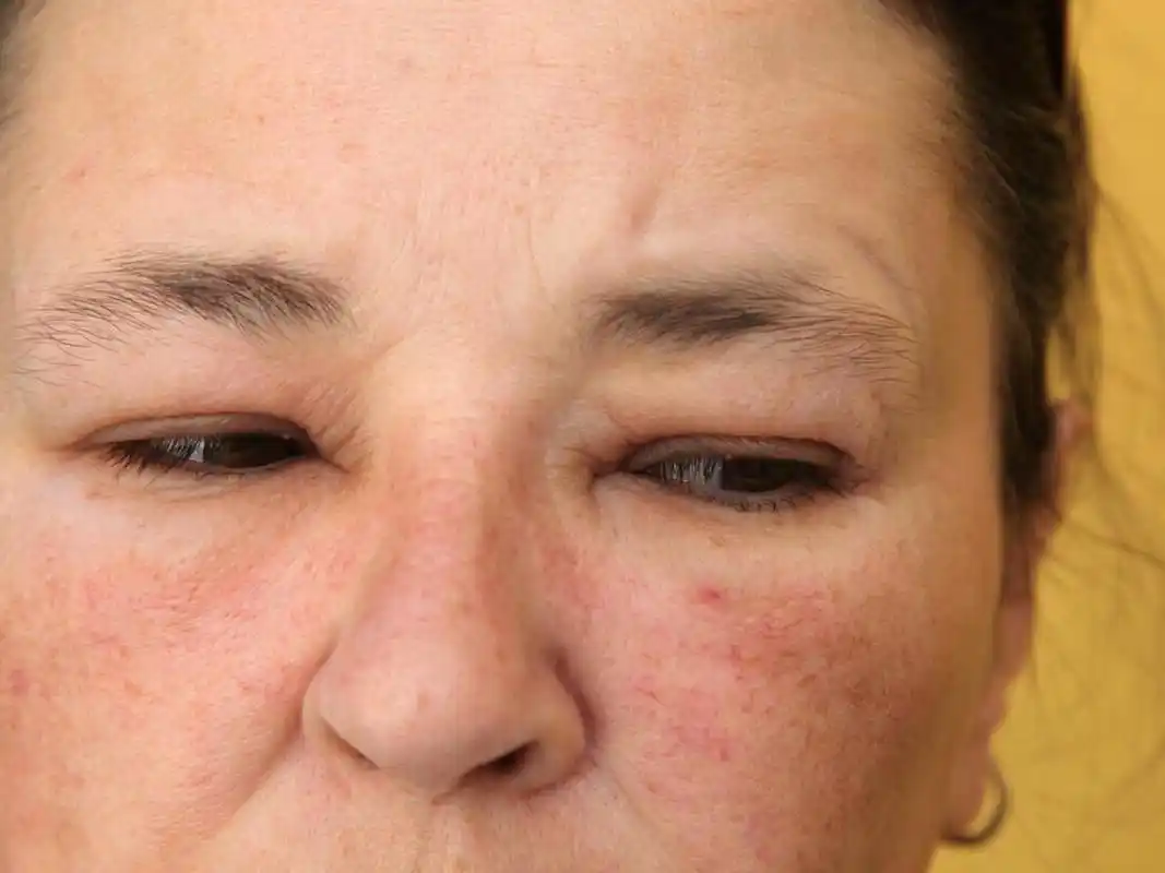 赶快去查一下血常规  1,面色苍白  面色苍白是指面部皮肤失去了正常的