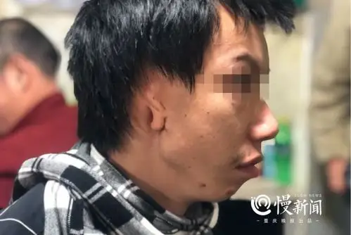 重庆29岁"无耳"小伙想要一对耳朵 爱心机构愿助他圆梦