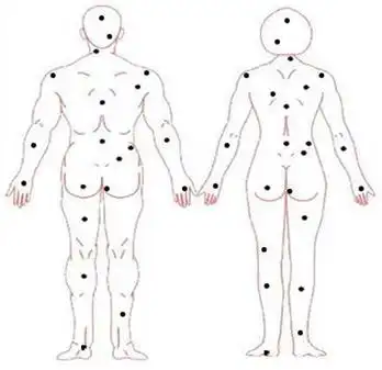 脚趾缝有痣的女人命运,痣相图解8大福痣,脚趾缝隙长痣寓意_易安殿