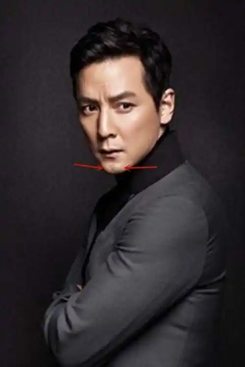 美人沟下巴有多好看?林青霞下巴凹陷成经典,戚薇变尖却失辨识度