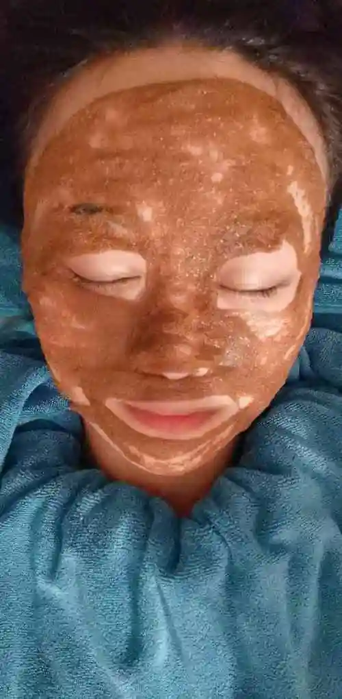 璇子美学皮肤管理(天街店)-"【项目】小气泡感谢dp送的的做脸券,提.