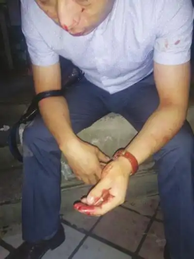 李先生被打后的照片