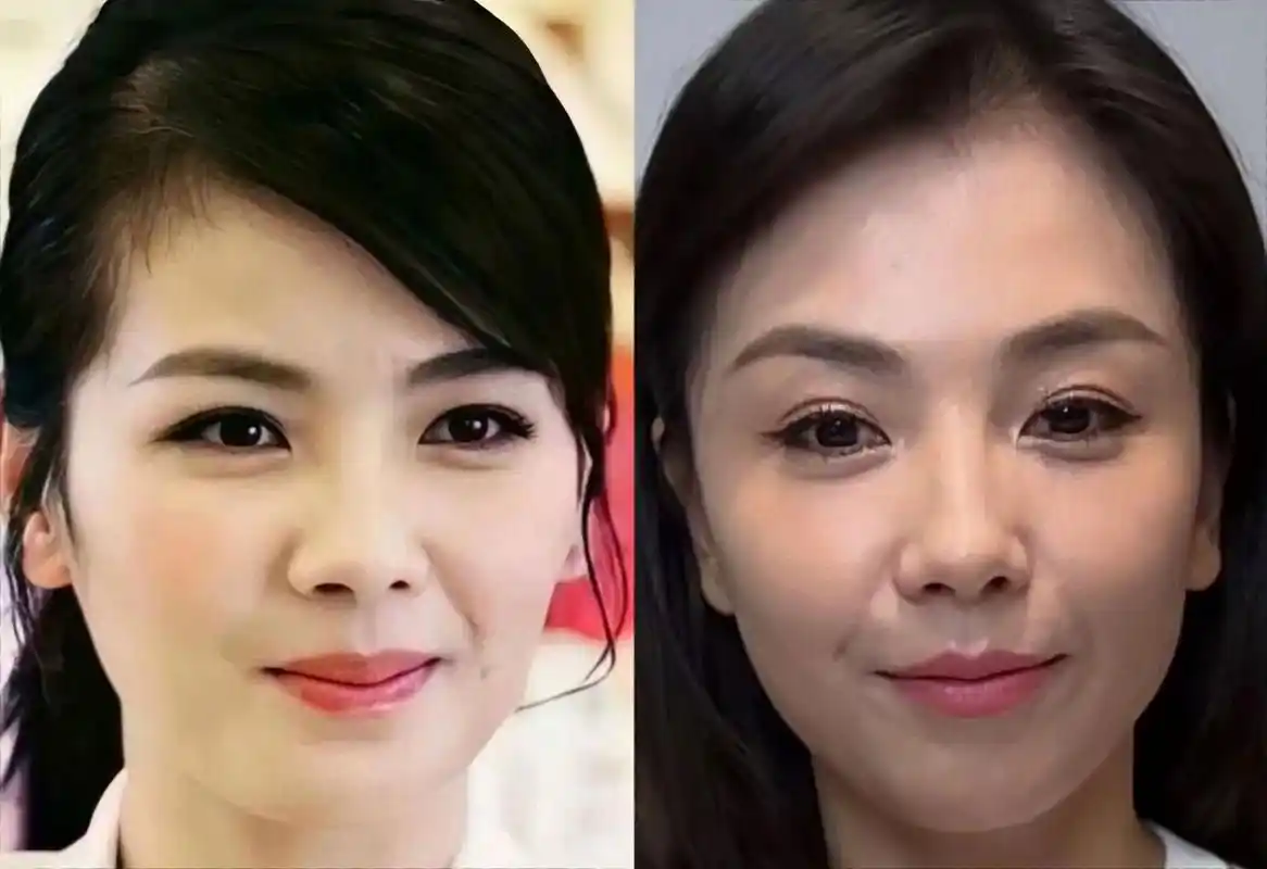 发生了啥? 右图是今天视频刷到的刘涛,很多人表示认不出,不像她了.