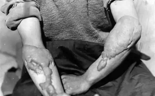 日本核辐射下的变异人形似怪物终身悲惨痛苦视频2