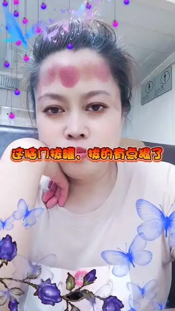 浪子痧红            11-1 21:28 来自 微博视频号 离不开的小火罐