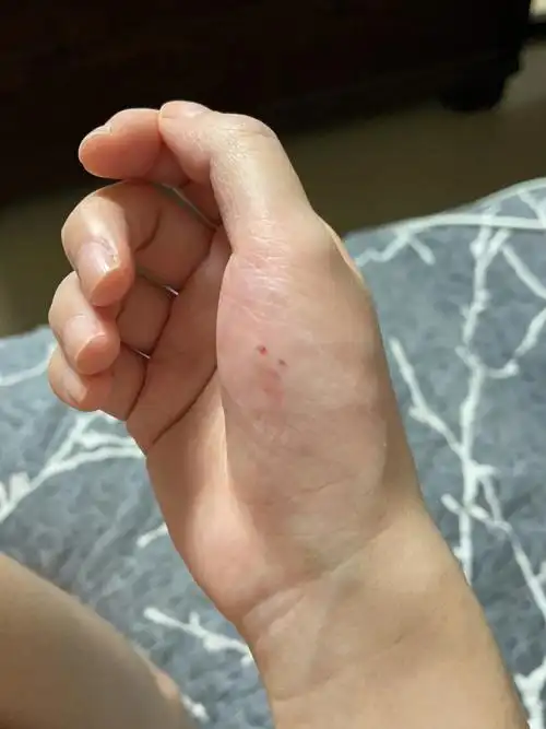 狗狗咬人 #全网脾气最差的泰迪