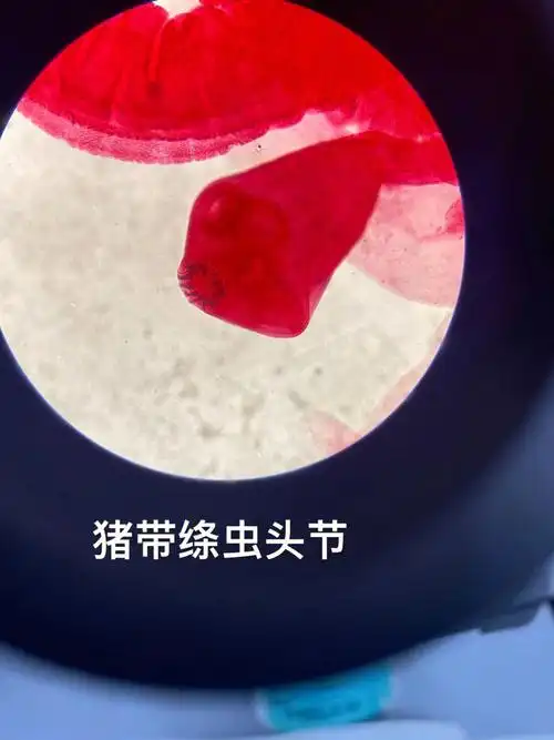 寄生虫检验   #猪带绦虫