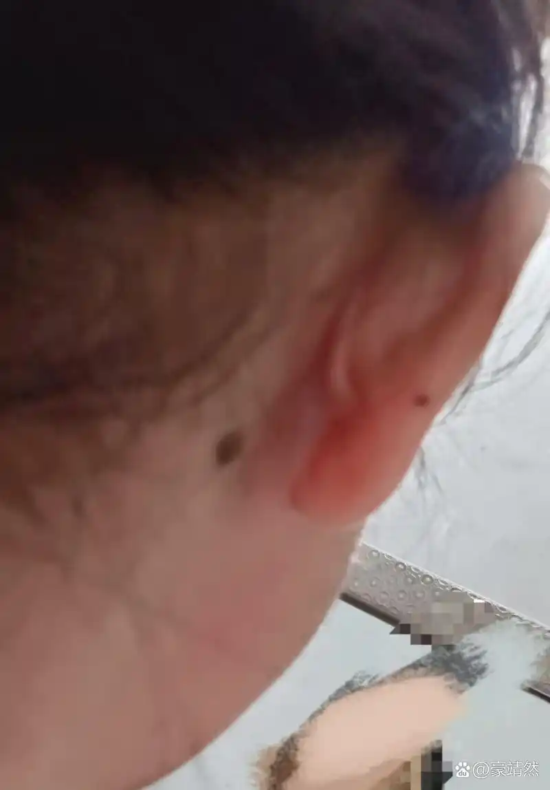 左耳边的痣,是我独特的印记.耳后有痣有什么说法?