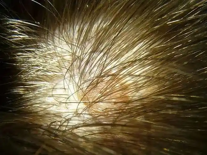 肉眼可见的除螨效果火爆日本的除螨贴24小时不间断除螨率高达97