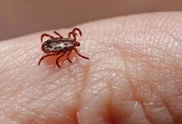 被蜱虫咬伤会怎么样?怎样处理和治疗呢