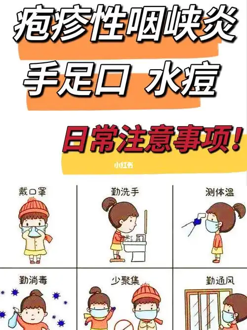 疱疹性咽峡炎手足口水痘要注意什么