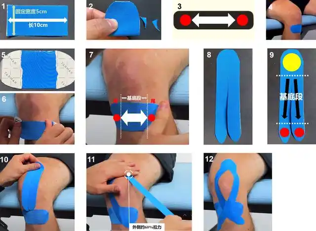 上期的文章中已经介绍了肌内效贴的原理和作用.