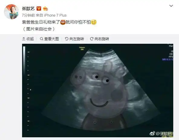 张歆艺晒b超照片宣布怀孕给36岁袁弘最好的礼物