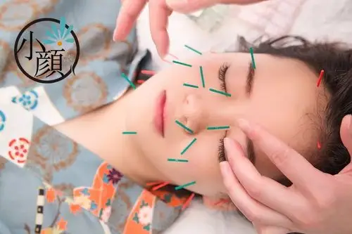 日式美容针灸